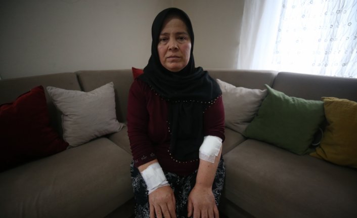 Düzce'de pitbull saldırısında yaralanan kadın yaşadıklarını unutamıyor