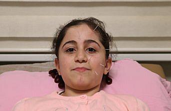 Yüz felci geçiren 10 yaşındaki çocuk akupunktur ile sağlığına kavuştu