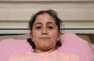 Yüz felci geçiren 10 yaşındaki çocuk akupunktur...