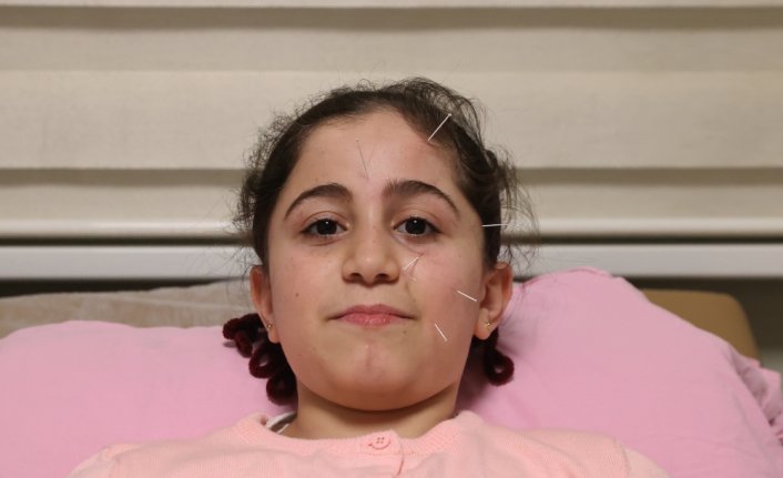 Yüz felci geçiren 10 yaşındaki çocuk akupunktur ile sağlığına kavuştu