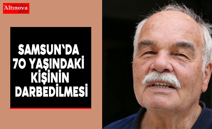 Samsun'da 70 yaşındaki kişinin darbedilmesi