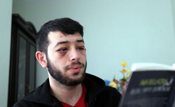 Göz kapağı sorunu iş bulmasına engel olunca ameliyat masasına yattı