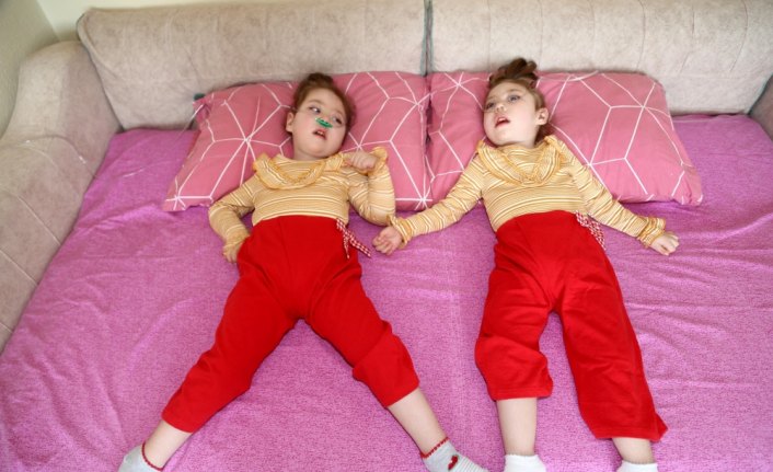 Hasta ikizlerin ailesi yardım bekliyor