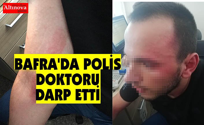 BAFRA'DA POLİS DOKTORU DARP ETTİ İDDİASI