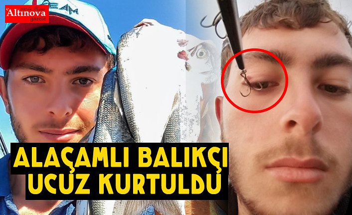 Amatör balıkçının göz kapağına saplanan "olta iğnesi" hastanede çıkarıldı