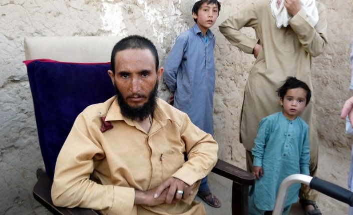 Pakistan'daki sığınmacılar 40 yıldır yaşamlarını zor şartlarda sürdürüyor