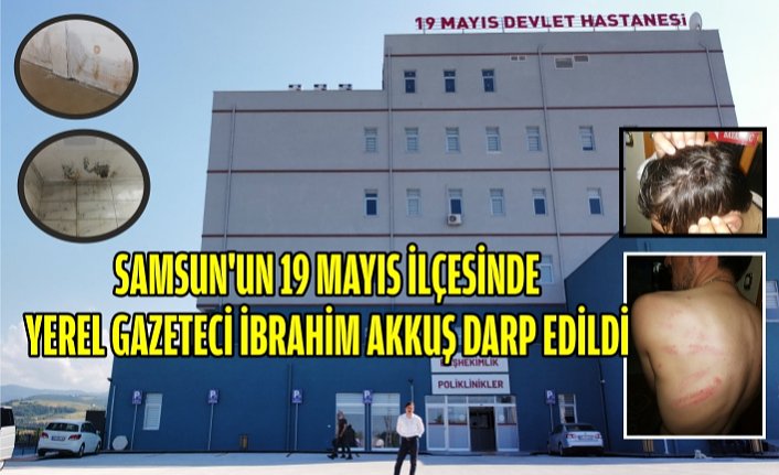 SAMSUN'UN 19 MAYIS İLÇESİNDE YEREL GAZETECİ İBRAHİM AKKUŞ DARP EDİLDİ