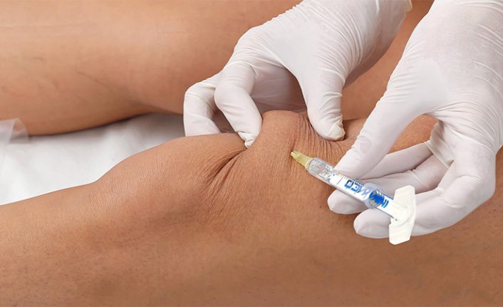 Kireçlenmenin kısa sürede tedavisi mümkün