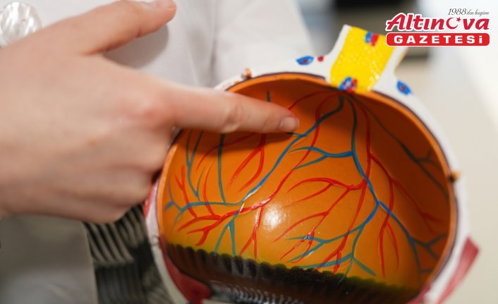 Retinadaki damar tıkanıklıkları görme kaybına sebep oluyor