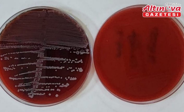 Karabük Üniversitesinden implant enfeksiyonlarına karşı yenilikçi yöntem