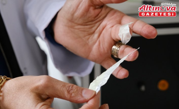 Hitit Üniversitesi'nde geliştirilen “yara örtüsü“nün endüstriye kazandırılması hedefleniyor