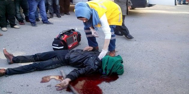 SOKAK ORTASINDA, KAFASINDAN VURULDU