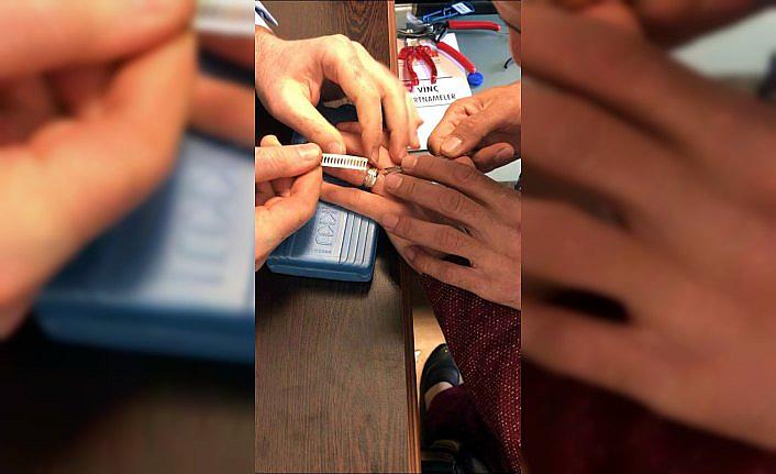 Parmağına sıkışan yüzüğü itfaiye ekipleri çıkardı