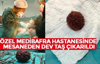ÖZEL MEDİBAFRA HASTANESİNDE MESANEDEN DEV TAŞ ÇIKARILDI