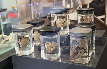 Sağlık müzesinde sergilenmeye başlayan bebek ve fetüsler 30 yaşında