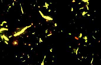 Farklı türlerdeki şekerlerde mikroplastiğe rastlandı