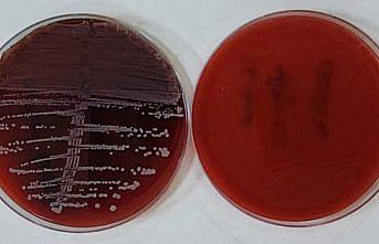Karabük Üniversitesinden implant enfeksiyonlarına karşı yenilikçi yöntem
