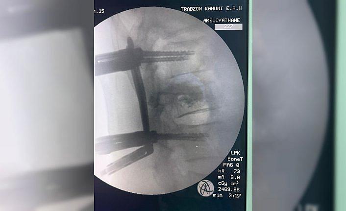 Trabzon'da omurga vidalama ameliyatı geçiren hasta sağlığına kavuştu