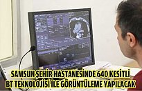 Samsun Şehir Hastanesinde 640 kesitli BT teknolojisi ile görüntüleme yapılacak