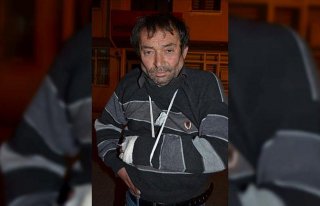 Odun keserken kolunu kesti