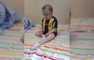 Cam kemik hastalığından kaybettiği oğlunun eşyalarını...