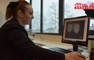 Trabzon'da kalkan balıklarının yaşlarını...