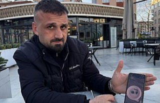 Rize'de burnundan zincir parçası çıkarılan...