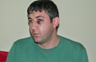 RANT DAYAĞI İDDİASI  