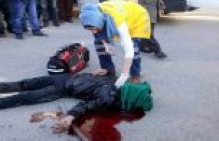 SOKAK ORTASINDA, KAFASINDAN VURULDU