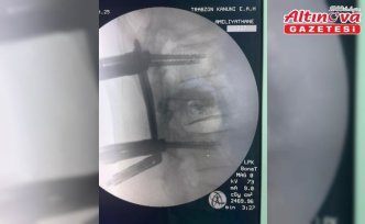 Trabzon'da omurga vidalama ameliyatı geçiren hasta sağlığına kavuştu