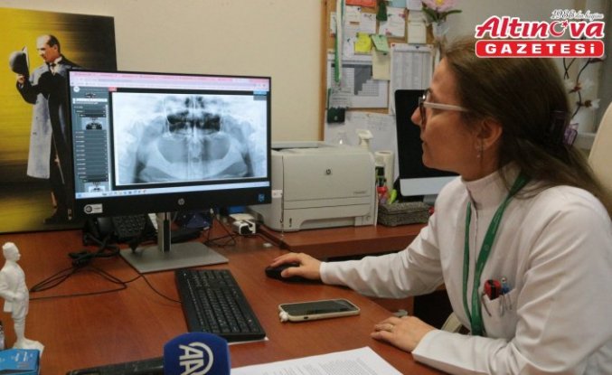 Çene kemiği kayıplarında yenilikçi tedavi yöntemi geliştirildi
