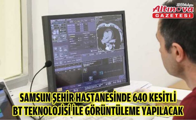 Samsun Şehir Hastanesinde 640 kesitli BT teknolojisi ile görüntüleme yapılacak