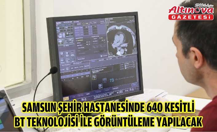 Samsun Şehir Hastanesinde 640 kesitli BT teknolojisi ile görüntüleme yapılacak